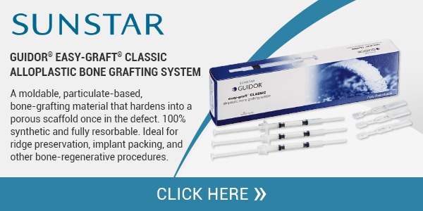 Guidor® Easy-Graft® Classic Alloplastic Bone Grafting System