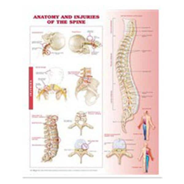 Anatomy and Injuries of the Spine 20x26" Anatomical Chart Ea