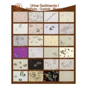 Urine Sediments 18x24" Wall Poster Ea