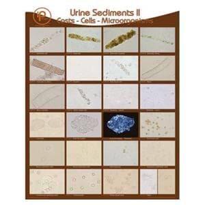 Urine Sediments II 19x24" Wall Poster Ea