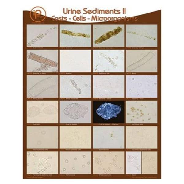 Urine Sediments II 19x24" Wall Poster Ea