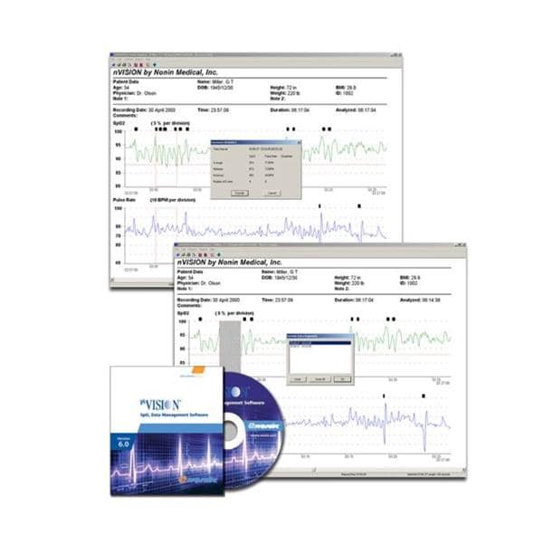 nVision Software System f/ Nonin Pulse Ox models with memory Ea