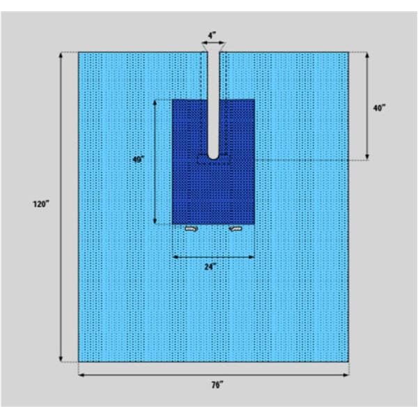 77x120" Non-Sterile Surgical Drape Fenestrated