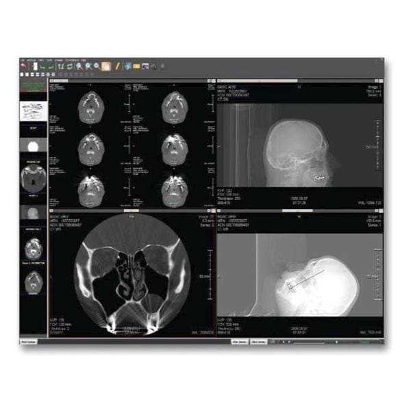 PACS Digital X-Ray System Ea