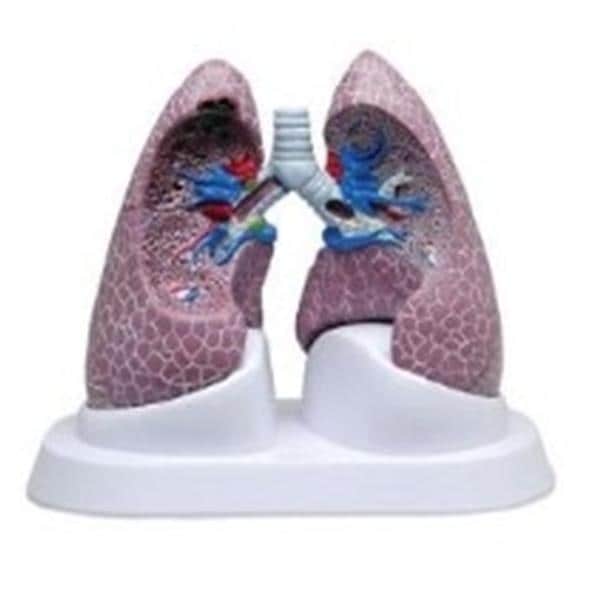 GPI Anatomicals Lung Set Model Ea