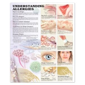 Understanding Allergies 20x26" Educational Chart Ea