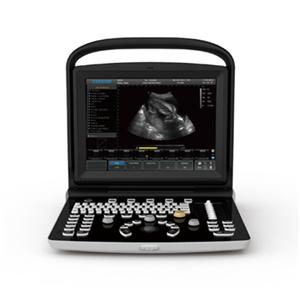 Ultrasound System Ea