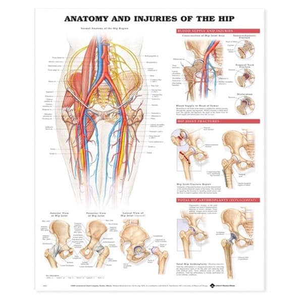 Injuries of the Hip 20x26" Anatomical Chart Ea