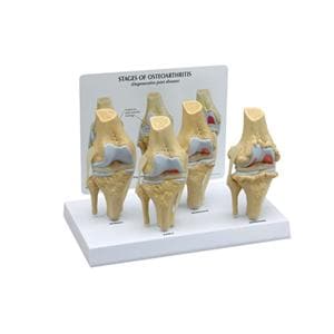 Knee Anatomical Model Ea
