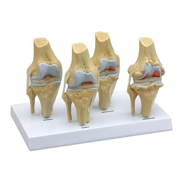 Knee Anatomical Model Ea