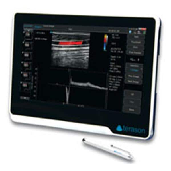 Usmart 3200T Ultrasound System With Transducer/5 Year Warranty Ea