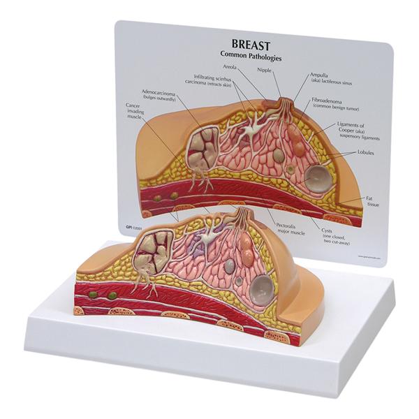 Breast Cross-Section Training Model Ea