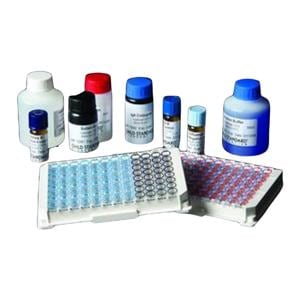 ANA3 Rubella IgG Assay Kit 1/Kt