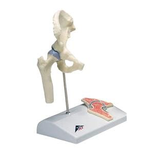 3B Hip Joint Anatomical Model Ea