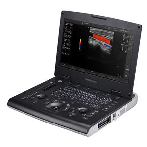 Versana Active Ultrasound System With Ea