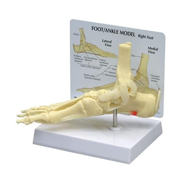 GPI Anatomicals Foot/Ankle/Plantar Fasciitis Full-Size Model Ea