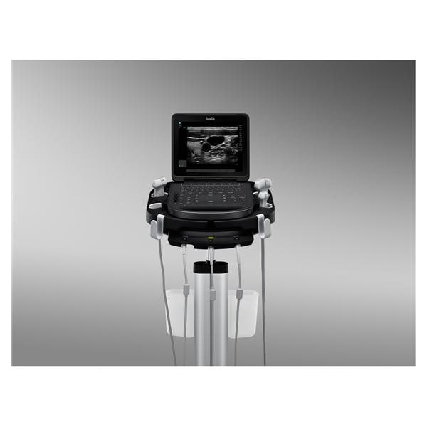 Sonosite Edge II Portable Ultrasound Reconditioned w/ Trnsdcr / POS Wrnty Ea