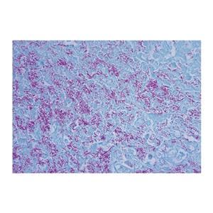 AFB: Acid Fast Bacillus Stain Kit Blue Ea Ea