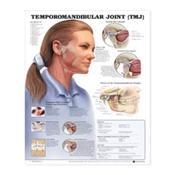 Poster Temporomandibular Joint 20 in x 26 in With Lamination Ea