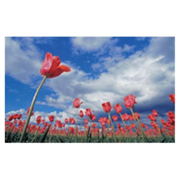 CeilingScenes Acoustic Tile Tulip Field 2-Tiles Vertical 24 in x 48 in Ea