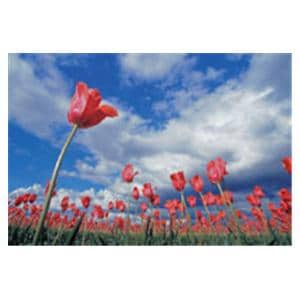 CeilingScenes Acoustic Tile Tulip Field 1-Tile Square 24 in x 24 in Ea