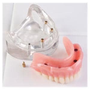 Over-Denture Locator Model LOC-4 Lower Ea