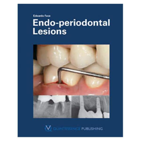 Book Endo-Periodontal Lesions Ea