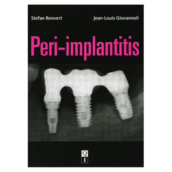 Book Peri-Implantitis Ea