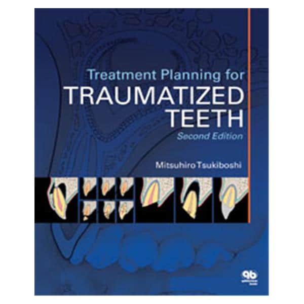 Book Treatment Planning for Traumatized Teeth 2nd Edition Ea