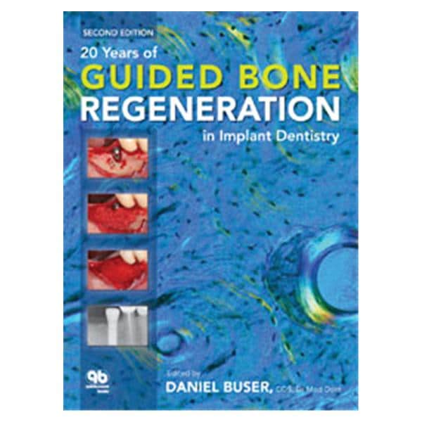 Book 20 Years of Guided Bone Regeneration in Implant Dentistry 2nd Edition Ea