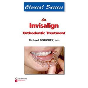 Book Clinical Success in Invisalign Orthodontic Treatment Ea