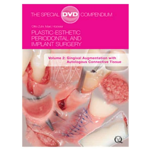 DVD Plstc-Esth Perio & Implnt Surg: Gingivl Augmentation Volume 2 Ea