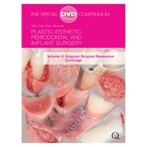 DVD Plastic-Esthetic Perio Imp Volume 3 Ea