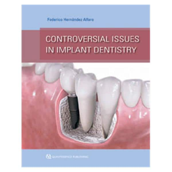 Book Controversial Issues in Implant Dentistry Ea