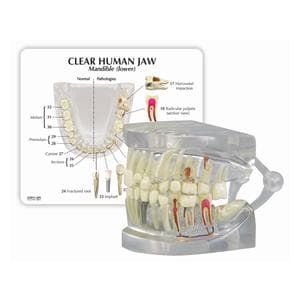 Patient Education Model Human Jaw 2 4/5 in x 2 1/2 in x 2 1/2 in Ea