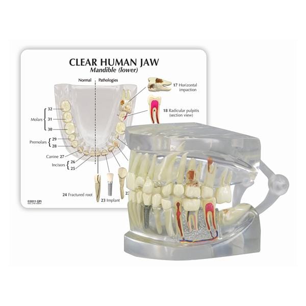 Patient Education Model Human Jaw 2 4/5 in x 2 1/2 in x 2 1/2 in Ea