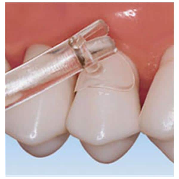 Cure-Thru Cervical Matrices Anterior Premolar 150/Bx