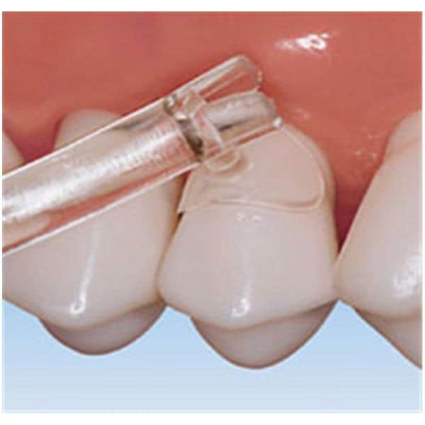 Cure-Thru Cervical Matrices 150/Bx