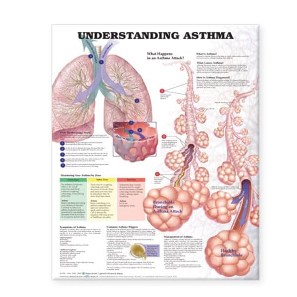 Understanding Asthma 20x26" Educational Chart EA
