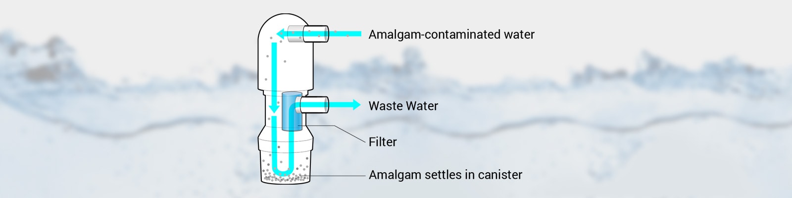 The EPA Amalgam Separator Ruling and your Practice