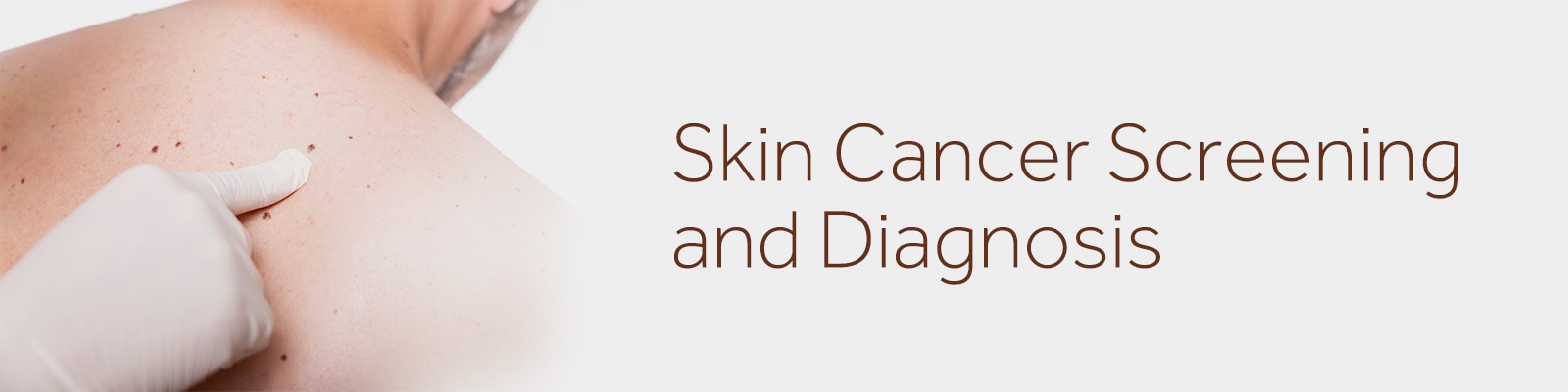 Equipos y suministros para la detección y el diagnóstico del cáncer de piel