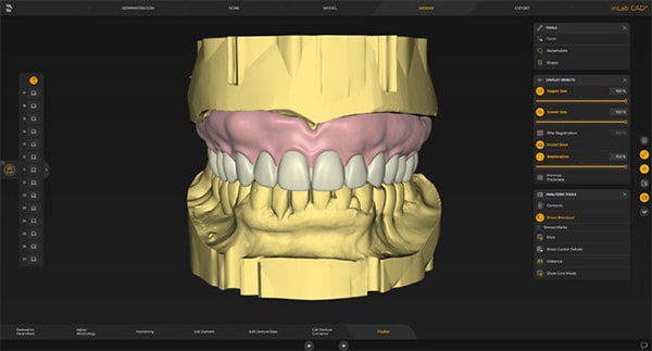 inLab CAD Software - Zahn Dental Labs